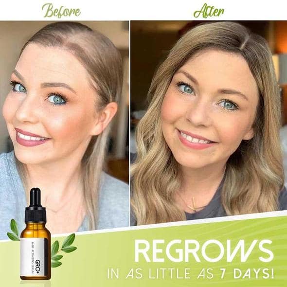 Gro+ Serum za aktiviranje kose - Image 3