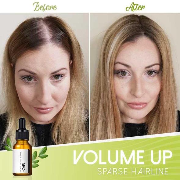 Gro+ Serum za aktiviranje kose - Image 4