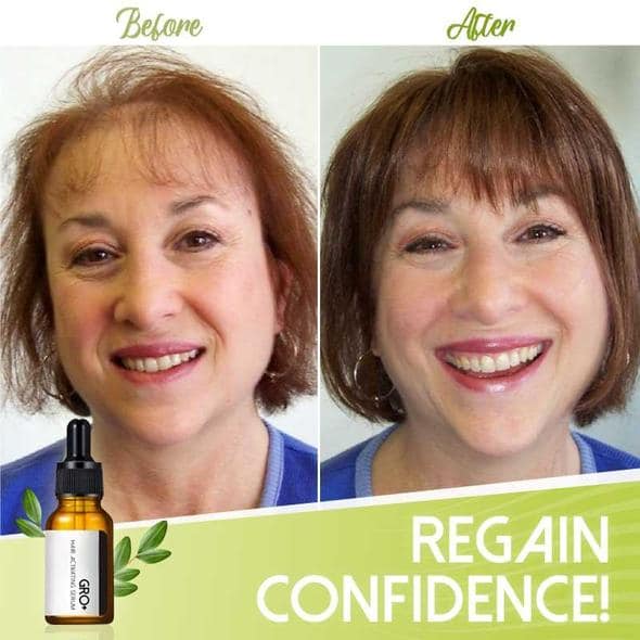 Gro+ Serum za aktiviranje kose - Image 6