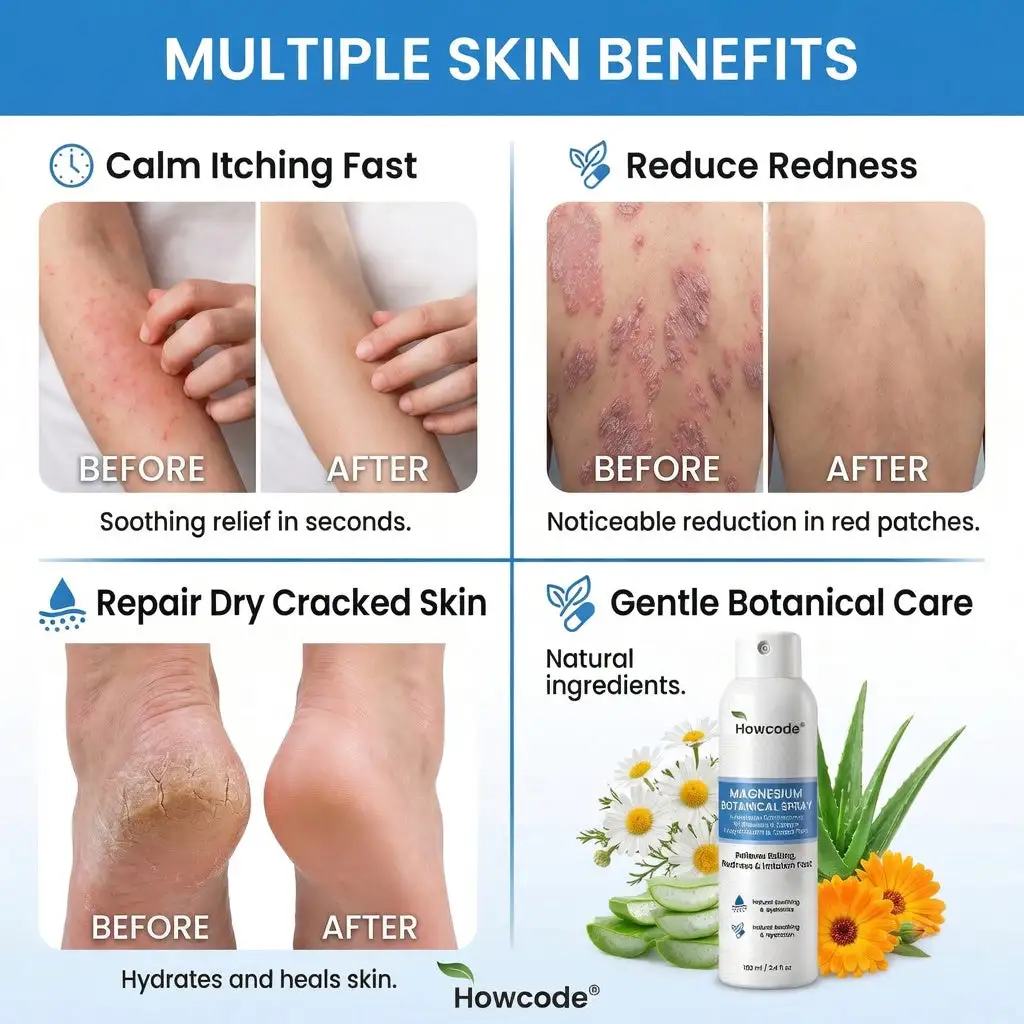 Howcode® magnezijev botanički sprej - Image 5