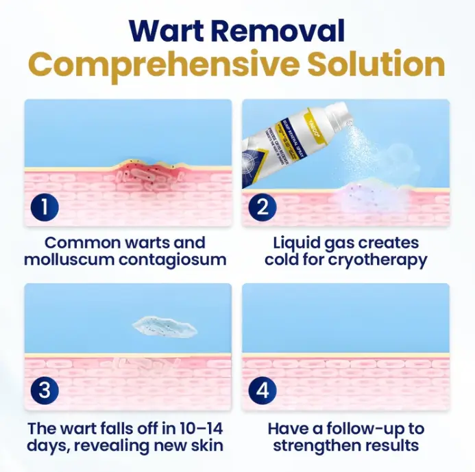 Yagoo® Chillique sprej za obnavljanje neravnina - Image 3