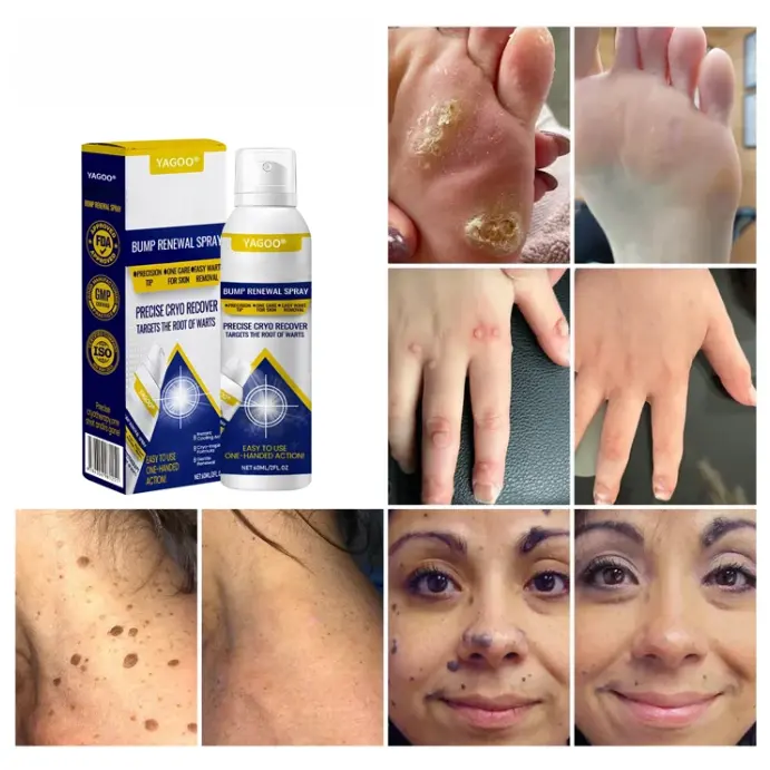 Yagoo® Chillique sprej za obnavljanje neravnina - Image 5